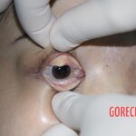 Initial inspection of deceased woman's body