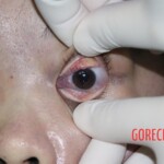 Initial inspection of deceased woman's body