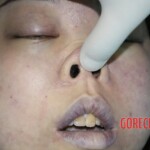 Initial inspection of deceased woman's body