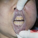 Initial inspection of deceased woman's body