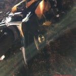 Severe burns caused by moped crash