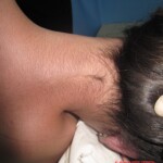 Sudden death during hospitalization