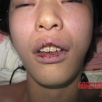 Sudden death during hospitalization