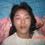 Sudden death during hospitalization