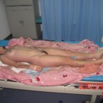 Sudden death during hospitalization