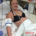 Young American woman nearly lost her leg in shark attack