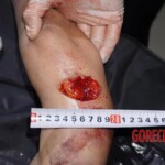 17-year-old Chinese girl committed suicide