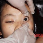 17-year-old Chinese girl committed suicide