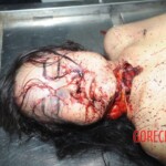 Chinese woman with deep wound on her neck