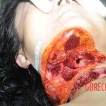 Chinese woman with deep wound on her neck