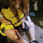 Female soccer fan loses multiple fingers after mishandling pyrotechnics