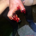 Female soccer fan loses multiple fingers after mishandling pyrotechnics