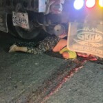 Truck squeezed woman's brain out