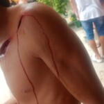 Violently attacked with machete while hanging out with friends