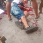 Violently attacked with machete while hanging out with friends