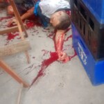 Violently attacked with machete while hanging out with friends