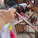 Violently attacked with machete while hanging out with friends