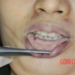 25-year-old Chinese woman commited suicide at her home