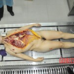 Autopsy of stabbed Chinese woman