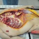 Autopsy of stabbed Chinese woman