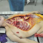 Autopsy of stabbed Chinese woman