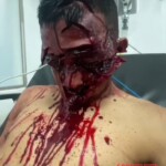 Brutal machete attack on street