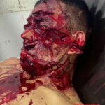 Brutal machete attack on street