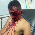 Brutal machete attack on street