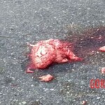 Collision with combine harvester tore off motorcyclist's face