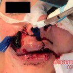 Dog ripped off part of her face