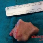 Dog ripped off part of her face