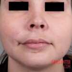 Dog ripped off part of her face