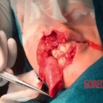 Dog ripped off part of her face