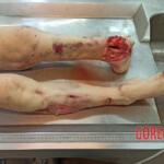 Elderly woman passed away after suffering fatal fall