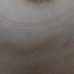 Forensic examination of stabbed Chinese woman