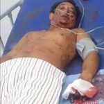 Indonesian guy stabbed during street fight