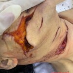 Initial forensic assessment of fatal stabbing victim