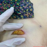 Initial forensic assessment of fatal stabbing victim