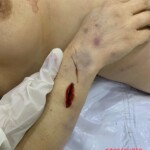 Initial forensic assessment of fatal stabbing victim