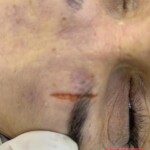 Initial forensic assessment of fatal stabbing victim