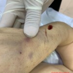 Initial forensic assessment of fatal stabbing victim