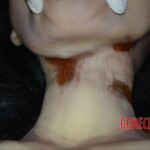 Initial forensic examination of strangled Chinese woman