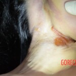 Initial forensic examination of strangled Chinese woman