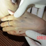 Initial forensic examination of strangled Chinese woman