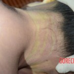 Initial forensic examination of strangled Chinese woman