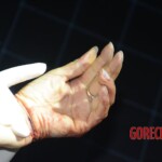 Initial forensic examination of strangled Chinese woman