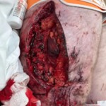 Legs destroyed in traffic accident