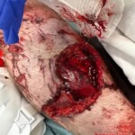 Legs destroyed in traffic accident