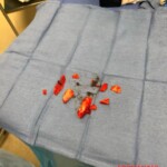 Legs destroyed in traffic accident