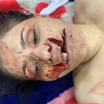 Woman died after sustaining fatal intraoral gunshot wound